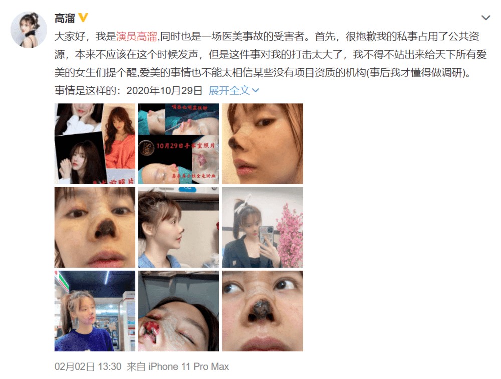 整容失败代价惨重！张檬痛哭毁星途，失去40部戏约悔恨终生